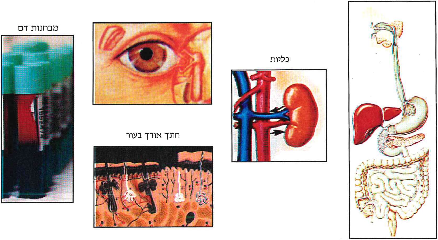 מערכת העיכול, כליות, חתך אורך באור, מבחנות דם.